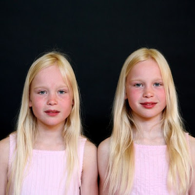 Identical Twins Guide: Separating Facts